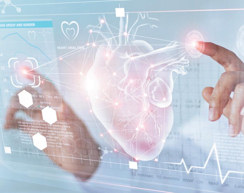 醫(yī)療電子心臟輔助設(shè)備儀器類領(lǐng)域傳導(dǎo)抗騷擾EMI解決方案